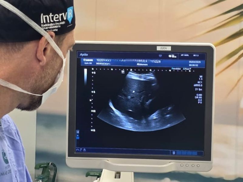 Ablação Percutânea de Tumores Hepáticos: Uma Opção Minimamente Invasiva e Eficaz