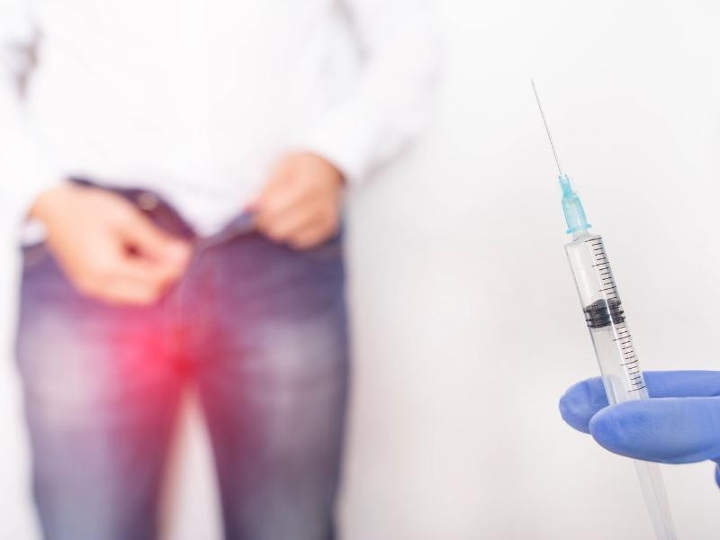Embolização de Varicocele em Cachoeirinha - RS