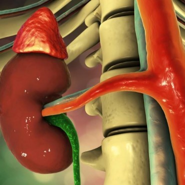 Angioplastia de Veia Cava em Sapucaia do Sul - RS