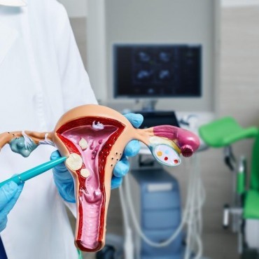 Tratamento de Miomatose Uterina em Sapucaia do Sul - RS