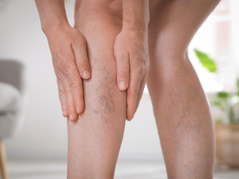 Trombose Aguda de Veia Porta