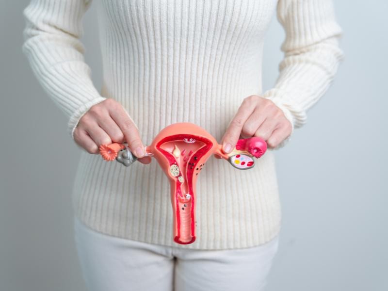 Embolização de Mioma Uterino em Nova Hartz - RS