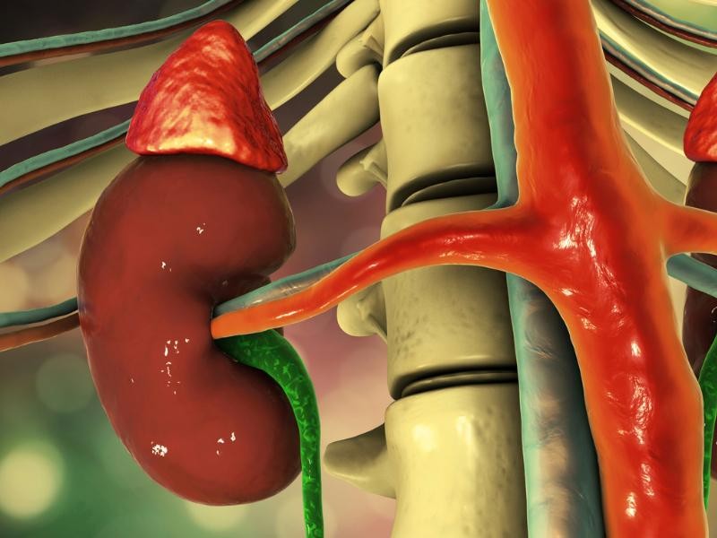 Angioplastia de Veia Cava em Sapucaia do Sul - RS
