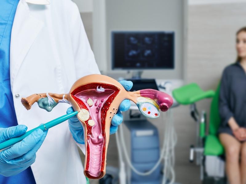 Tratamento de Miomatose Uterina em Sapucaia do Sul - RS